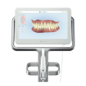 itero scanner